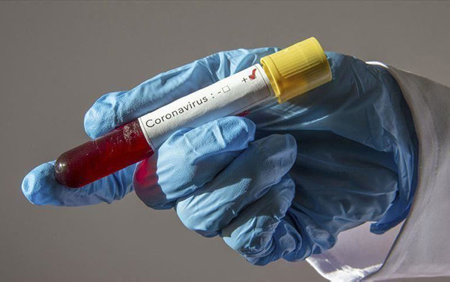 Azərbaycanda daha 38 nəfərdə koronavirus aşkarlandı - 79-u sağaldı