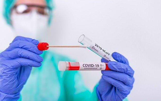 Son sutkada koronavirusdan 44 nəfər öldü