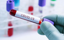 Daha 471 nəfər koronavirusa yoluxdu - 5 pasiyent öldü
