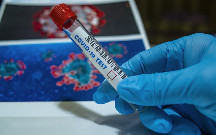 Daha 478 nəfərdə koronavirus aşkarlandı - 7 nəfər vəfat etdi