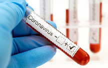 Daha 588 nəfər koronavirusa yoluxdu - 7 pasiyent öldü