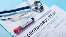 Azərbaycanda daha 126 nəfər koronavirusa yoluxdu, 144 nəfər sağaldı