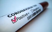 Azərbaycanda daha 1 052 nəfər koronavirusa yoluxub, 4 067 nəfər sağalıb