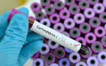 Klublarımızın koronavirus testlərinin nəticəsi açıqlandı