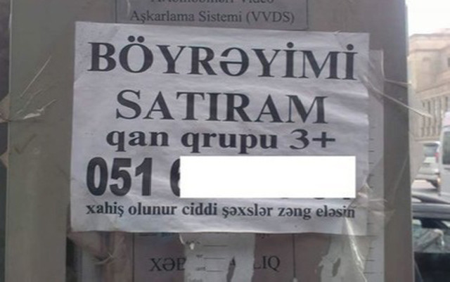 Azərbaycanda orqanlarını satışa çıxaranlara icazə var? - Video