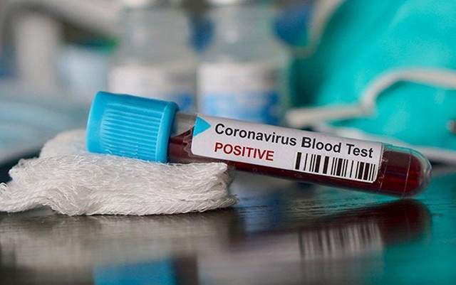 449 nəfər sağaldı, 352 nəfərdə koronavirus aşkarlandı