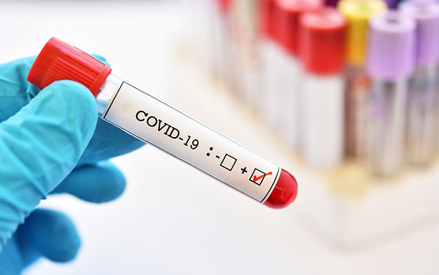 Daha 188 nəfər koronavirusa yoluxdu, 115 nəfər sağaldı