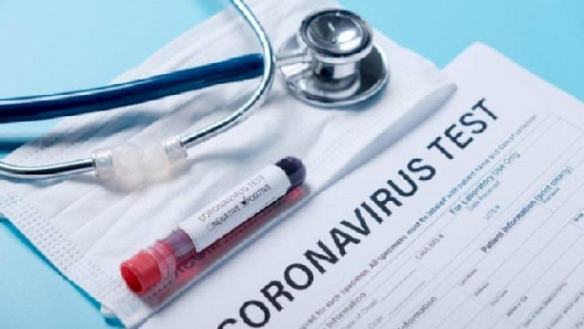 Azərbaycanda daha 126 nəfər koronavirusa yoluxdu, 144 nəfər sağaldı