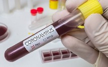 Azərbaycanda daha 15 nəfər koronavirusa yoluxub, ölən olmayıb